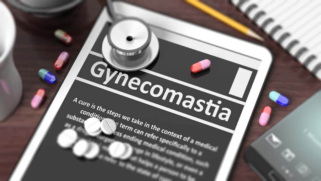 gynecomastia caused by drugs