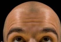 bald guy